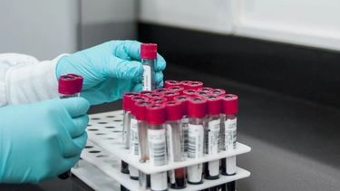 Baradero: no habrá análisis en el laboratorio del Hospital Lino Piñeiro Baradero: no habrá análisis en el laboratorio del Hospital Lino Piñeiro