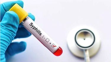 Argentina registra un aumento sostenido de casos de sífilis, especialmente en adolescentes y personas jóvenes.