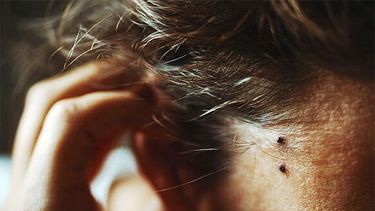 AlianzaMelaNomás. “El rol del peluquero como aliado en la detección temprana del melanoma es un ejemplo claro de cómo la salud puede estar presente en los espacios más cotidianos”.