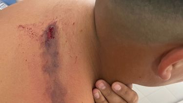 Dispararon a un niño de 11 años en Zona Norte en San Nicolás. Dispararon a un niño de 11 años en Zona Norte en San Nicolás.