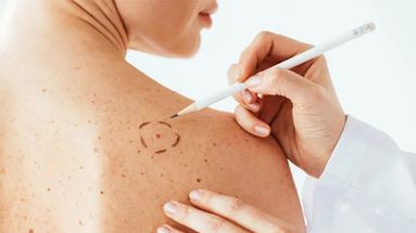 Día Mundial contra el Cáncer. Si bien la exposición al sol aumenta durante el verano, los cuidados deben permanecer todo el año. Día Mundial contra el Cáncer. Si bien la exposición al sol aumenta durante el verano, los cuidados deben permanecer todo el año.