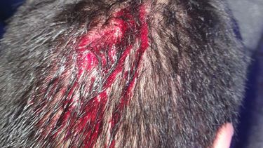 Al adolescente le provocaron varios cortes con un elemento cortante utilizado en clases. Al adolescente le provocaron varios cortes con un elemento cortante utilizado en clases.