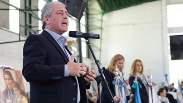 Laura Clark- Martiacutenez se puso la peluca Laura Clark- Martiacutenez se puso la peluca